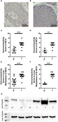 Elevated sortilin expression discriminates functional from non-functional neuroendocrine tumors and enables therapeutic targeting